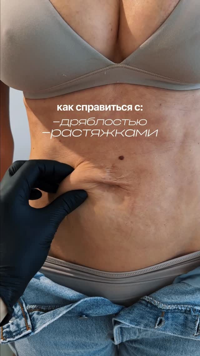 Post 1 by Proderma Middle East on Instagram (video)