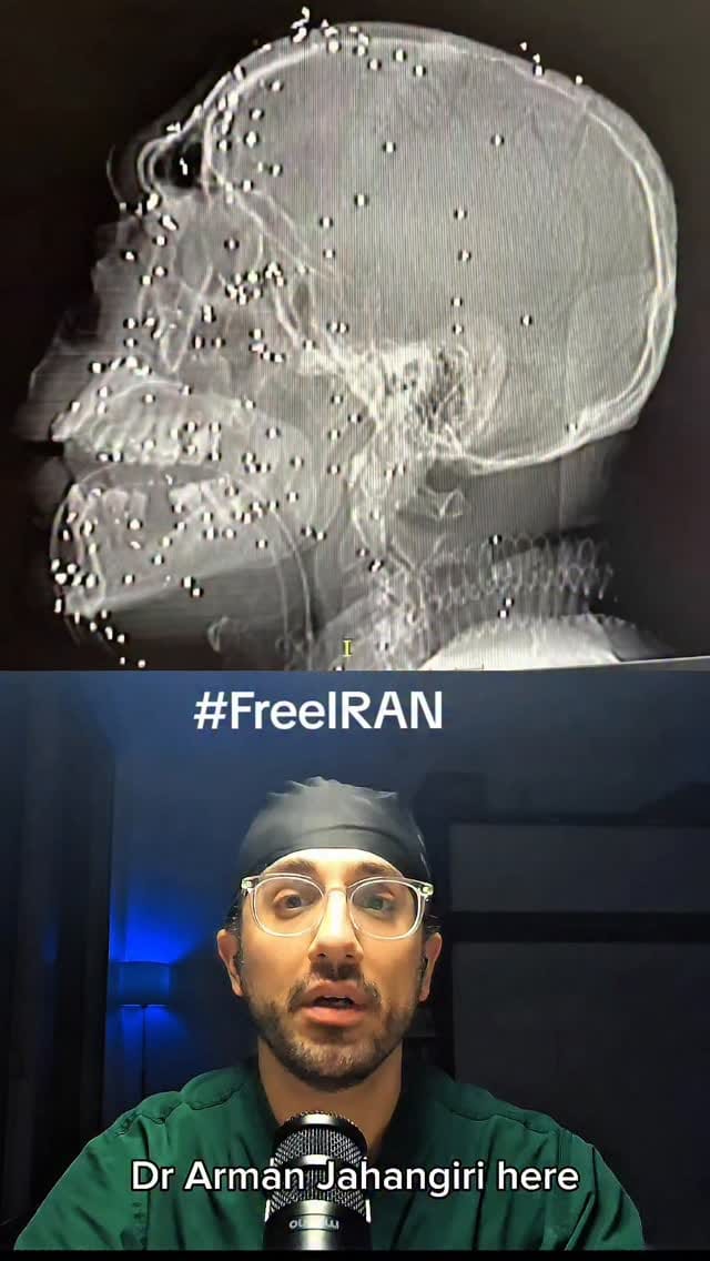 Post 1 by Mace Hamidi on Instagram (video)