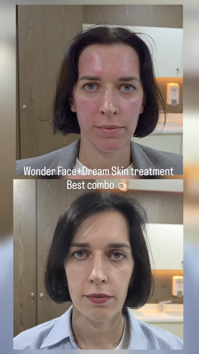Post 1 by Mariia Aesthetician on Instagram (video)