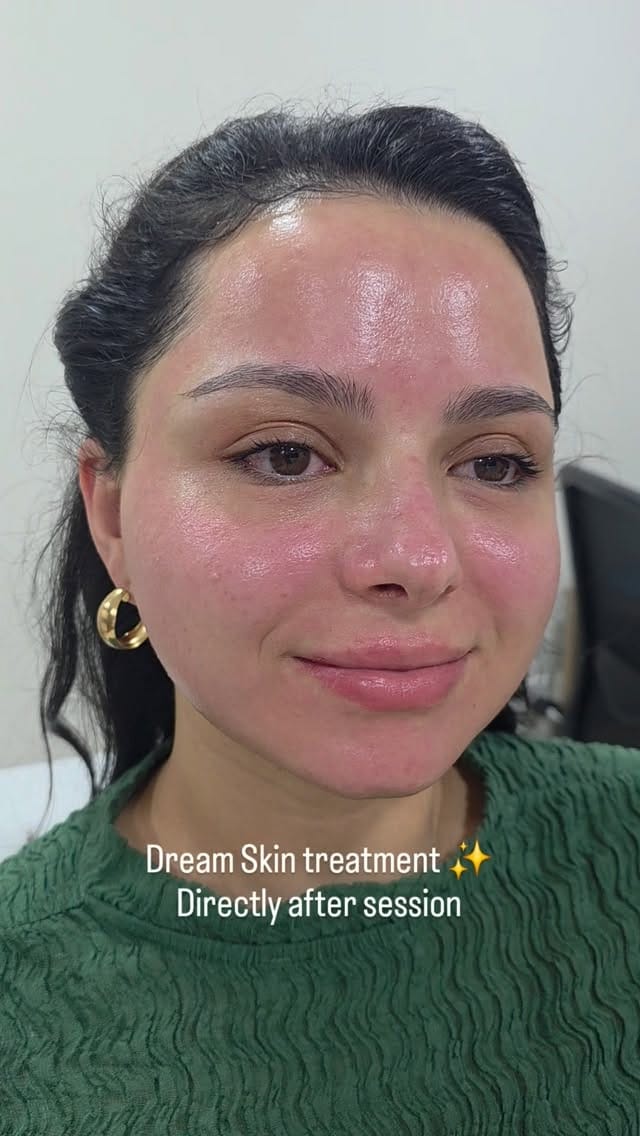 Post 3 by Mariia Aesthetician on Instagram (video)