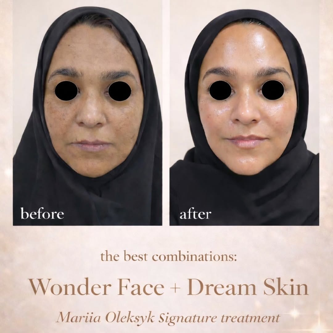 Post 4 by Mariia Aesthetician on Instagram (image)