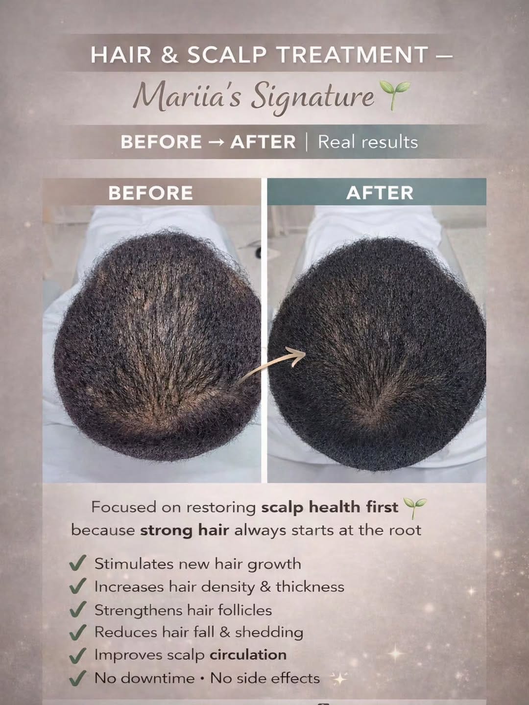 Post 5 by Mariia Aesthetician on Instagram (image)