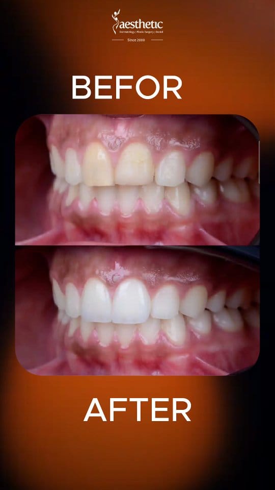 Post 5 by Aesthetic Polyclinic on Instagram (video)