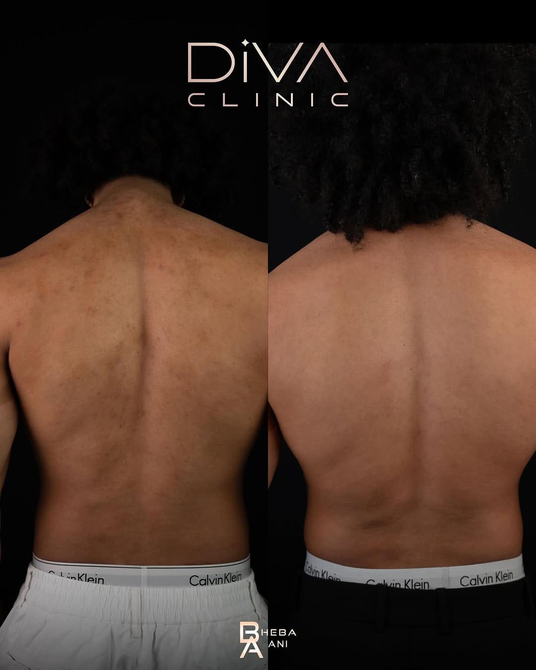 Post 2 by Diva Clinic on Instagram (carousel)