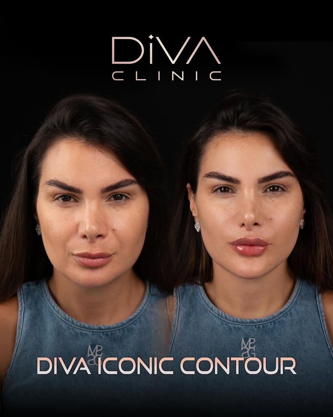 Post 8 by Diva Clinic on Instagram (carousel)