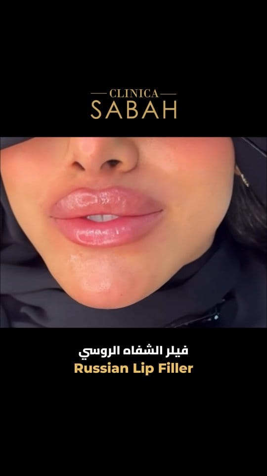 Post 6 by Clinicasabah I كلينيكا صباح on Instagram (video)