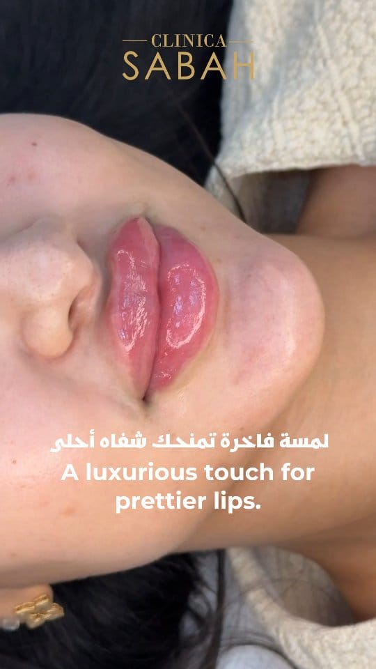 Post 3 by Clinicasabah I كلينيكا صباح on Instagram (video)