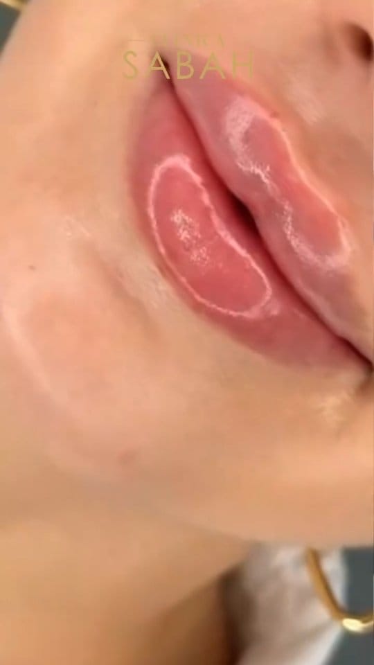 Post 5 by Clinicasabah I كلينيكا صباح on Instagram (video)