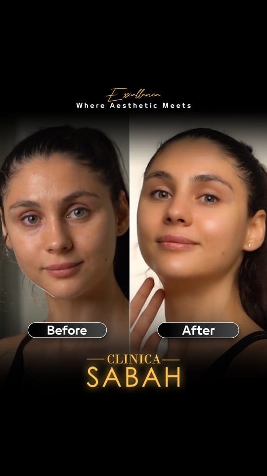 Post 10 by Clinicasabah I كلينيكا صباح on Instagram (video)