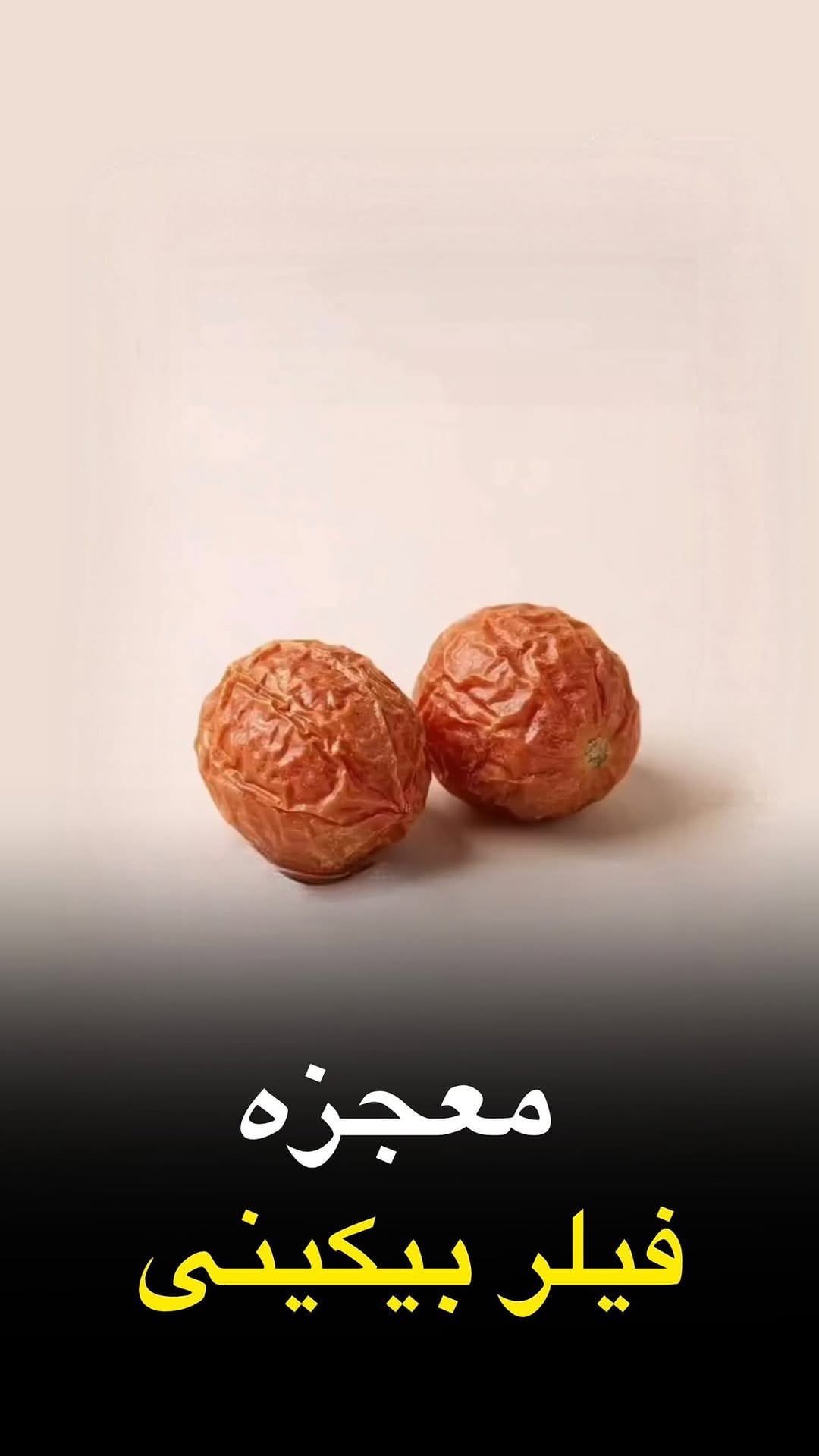 Post 5 by فيلر بادى/ژل لب كانتورينگ/بوتاكس/اندوليفت/جوانساز on Instagram (video)