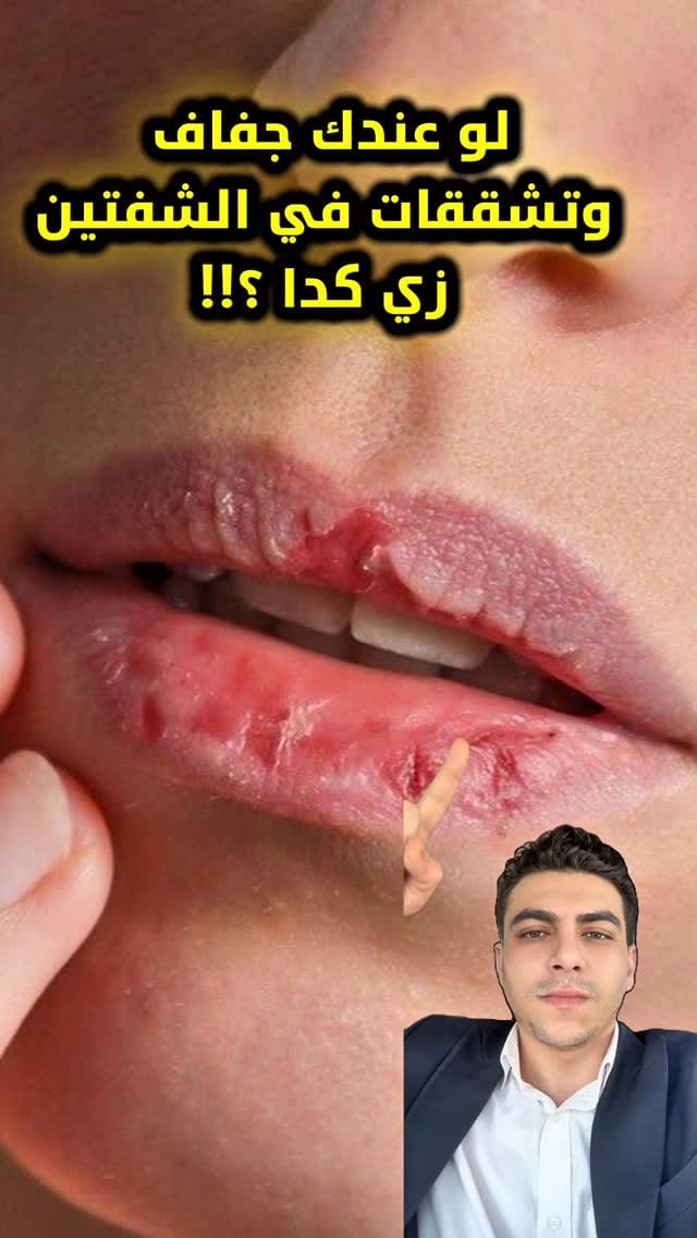 Post 1 by Nasr Hany on Instagram (video)