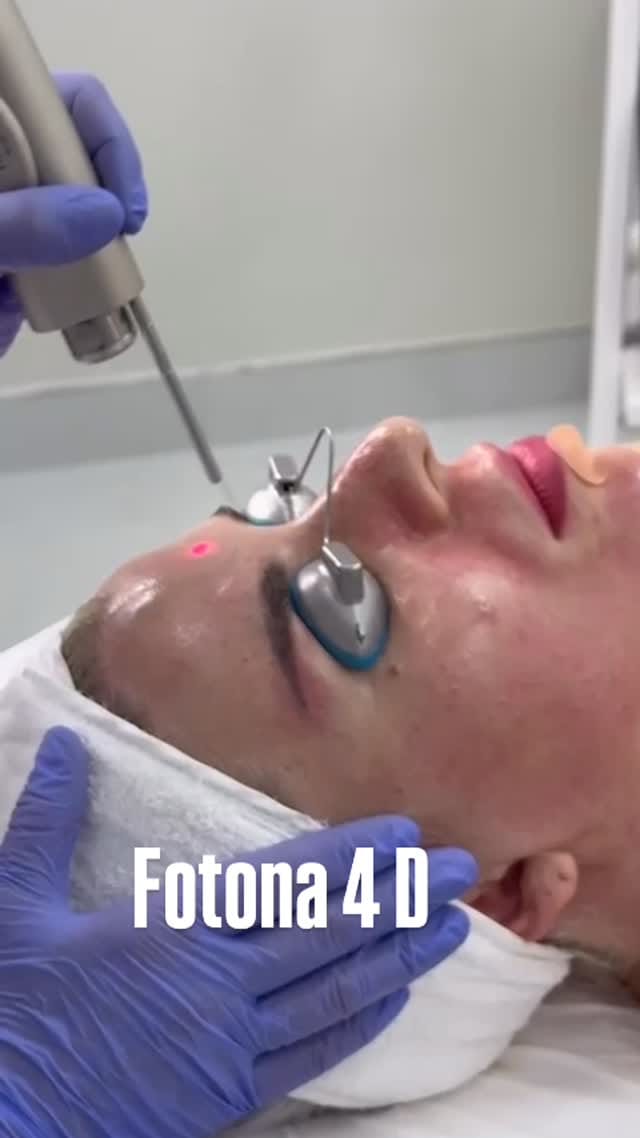 Post 5 by Filler , Botox Pico laser BBL/ Halo Ultraformer Morpheus8 on Instagram (video)