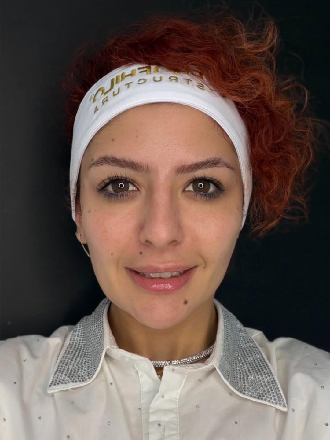 Post 9 by Filler , Botox Pico laser BBL/ Halo Ultraformer Morpheus8 on Instagram (carousel)