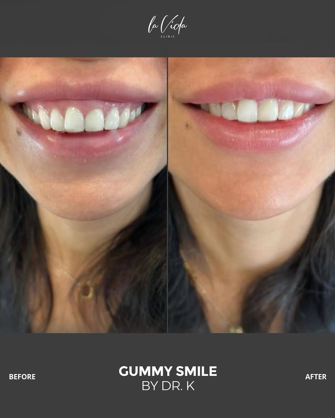 Post 4 by La Vida Aesthetic Clinic   عيادة لاڤيدا on Instagram (image)