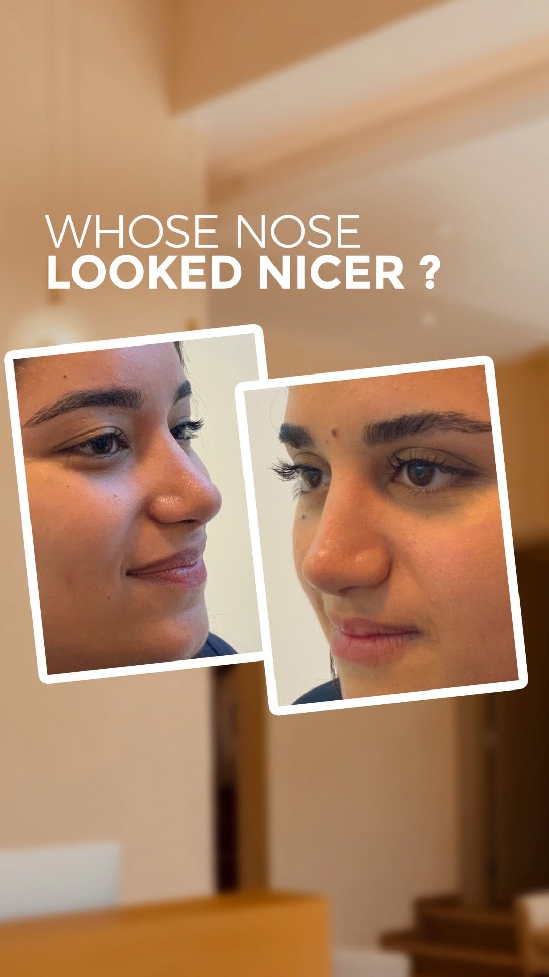 Post 5 by La Vida Aesthetic Clinic   عيادة لاڤيدا on Instagram (video)