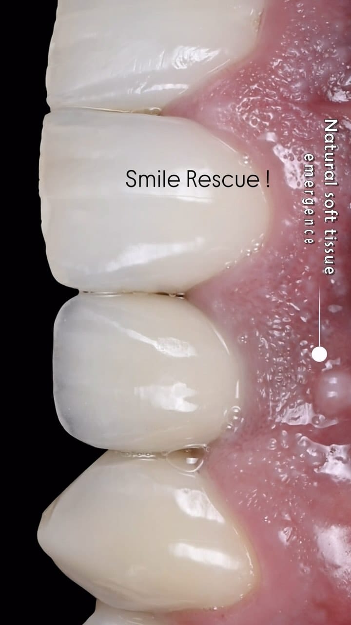 Post 10 by Kamal Kiswani on Instagram (video)