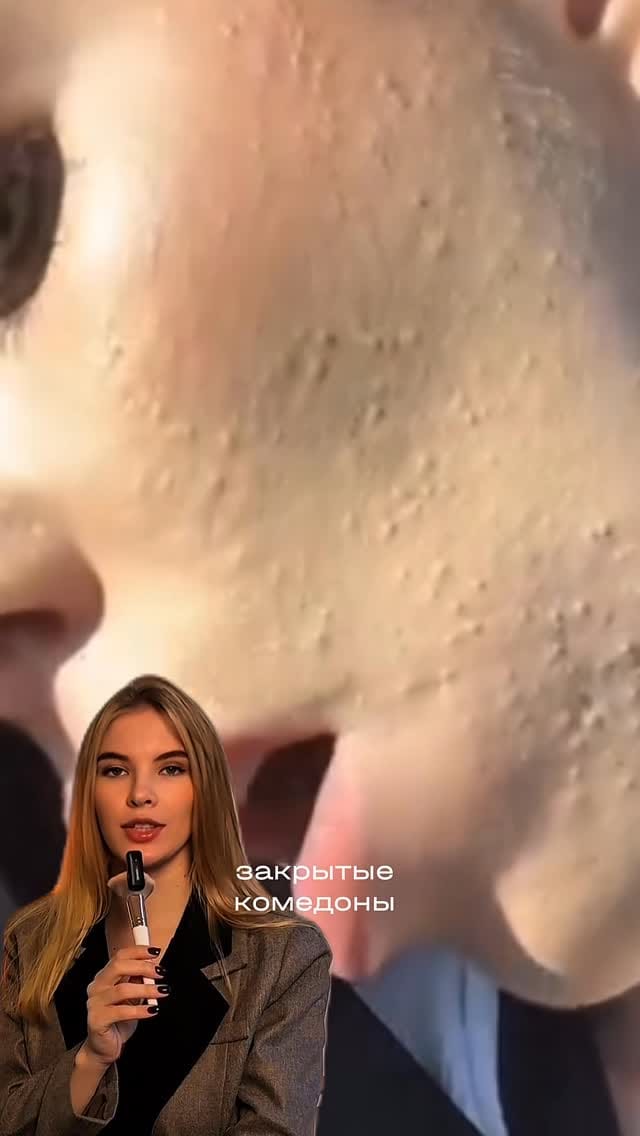 Post 1 by КОСМЕТОЛОГИЯ | МОСКВА on Instagram (video)