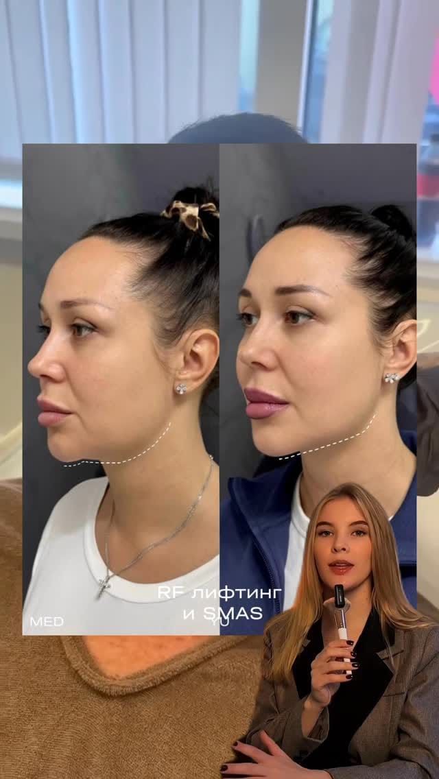 Post 2 by КОСМЕТОЛОГИЯ | МОСКВА on Instagram (video)