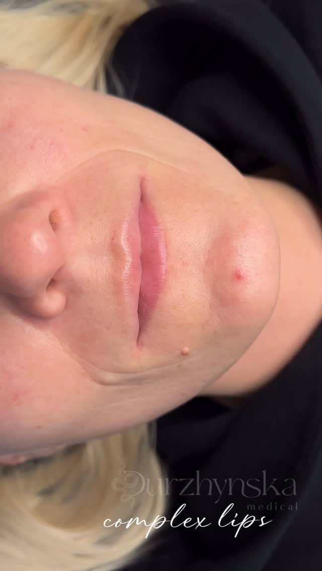 Post 5 by Юлія Дуржинська | Косметолог Одеса / Дубай on Instagram (video)