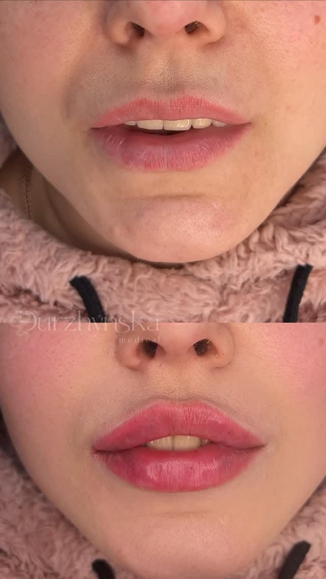 Post 9 by Юлія Дуржинська | Косметолог Одеса / Дубай on Instagram (video)