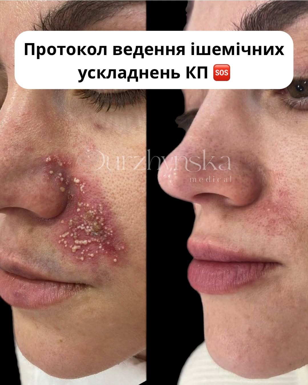 Post 4 by Юлія Дуржинська | Косметолог Одеса / Дубай on Instagram (carousel)