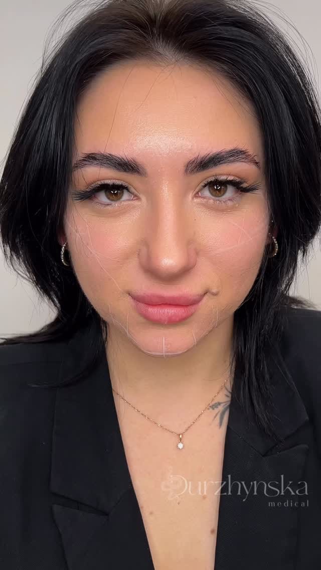 Post 2 by Юлія Дуржинська | Косметолог Одеса / Дубай on Instagram (video)