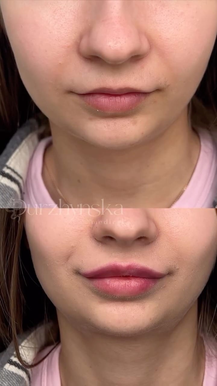 Post 1 by Юлія Дуржинська | Косметолог Одеса / Дубай on Instagram (video)