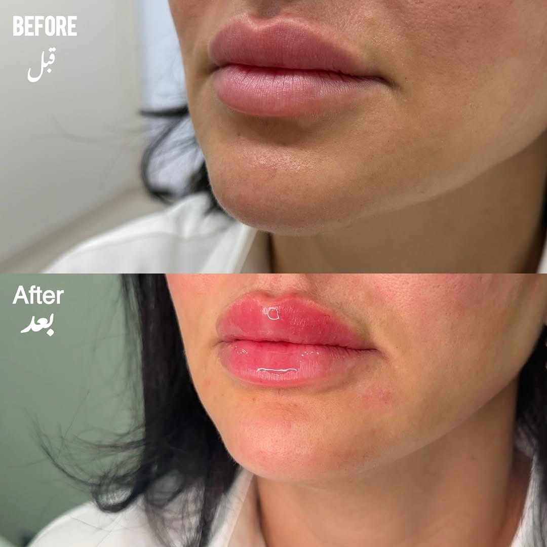 Post 10 by د . رنده النهاري                            Dr.Randa Alnahari on Instagram (image)