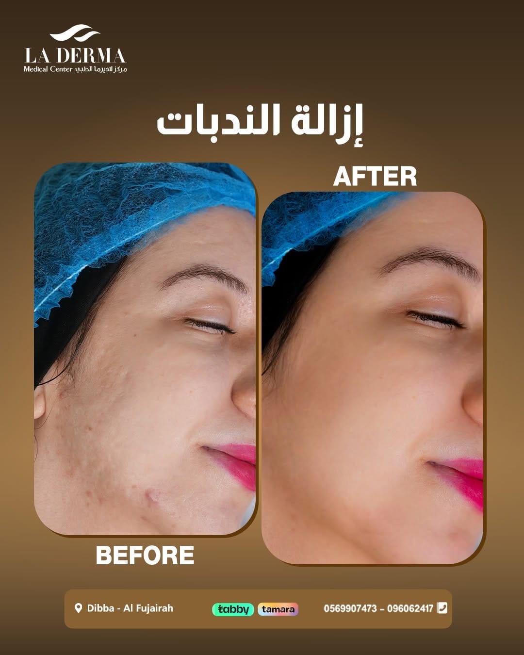 Post 2 by La Derma Medical Center on Instagram (image)
