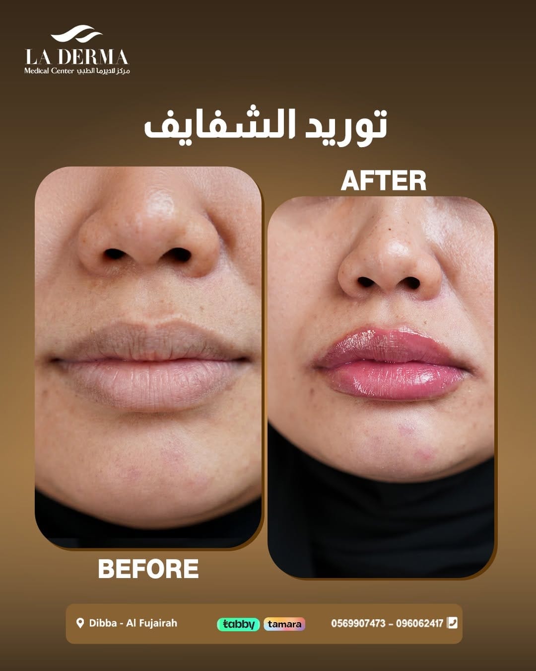 Post 4 by La Derma Medical Center on Instagram (image)