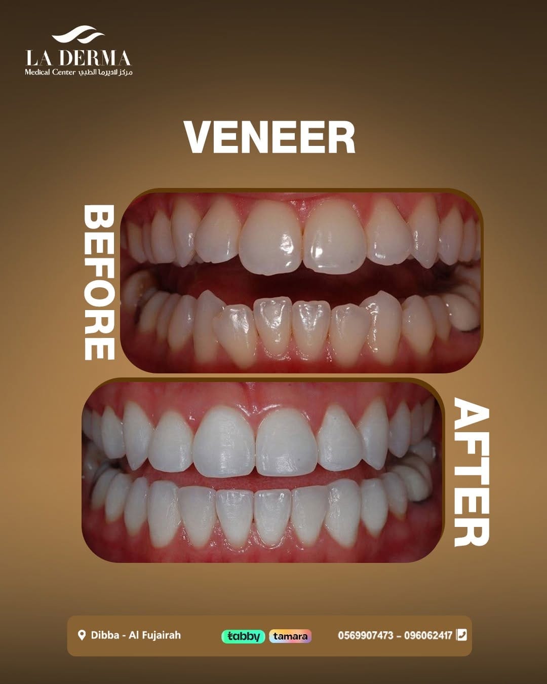 Post 6 by La Derma Medical Center on Instagram (image)