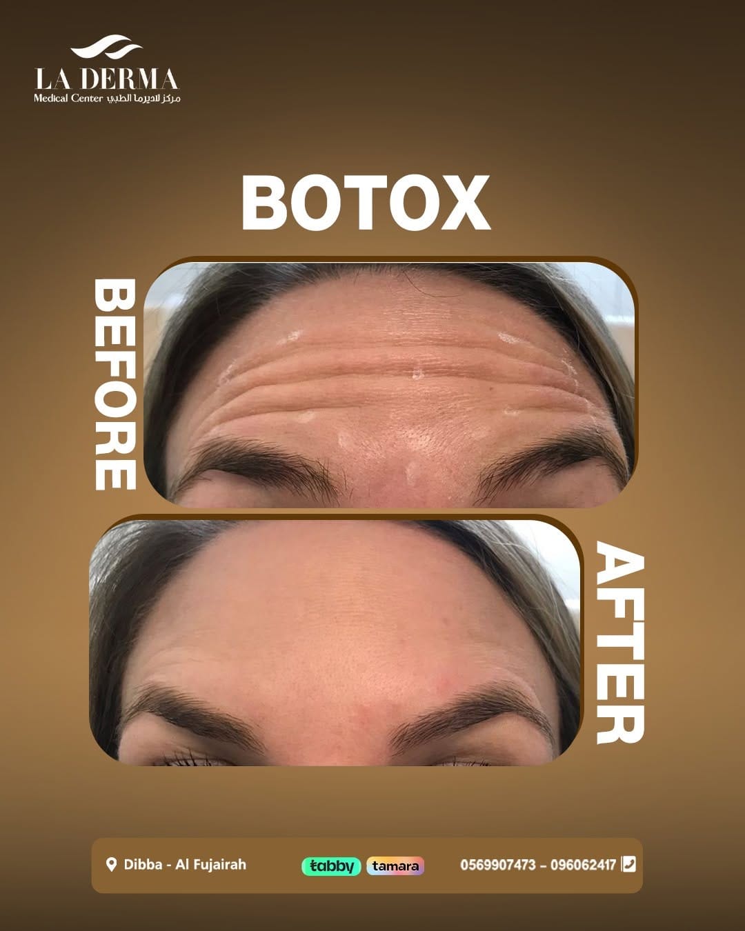 Post 10 by La Derma Medical Center on Instagram (image)