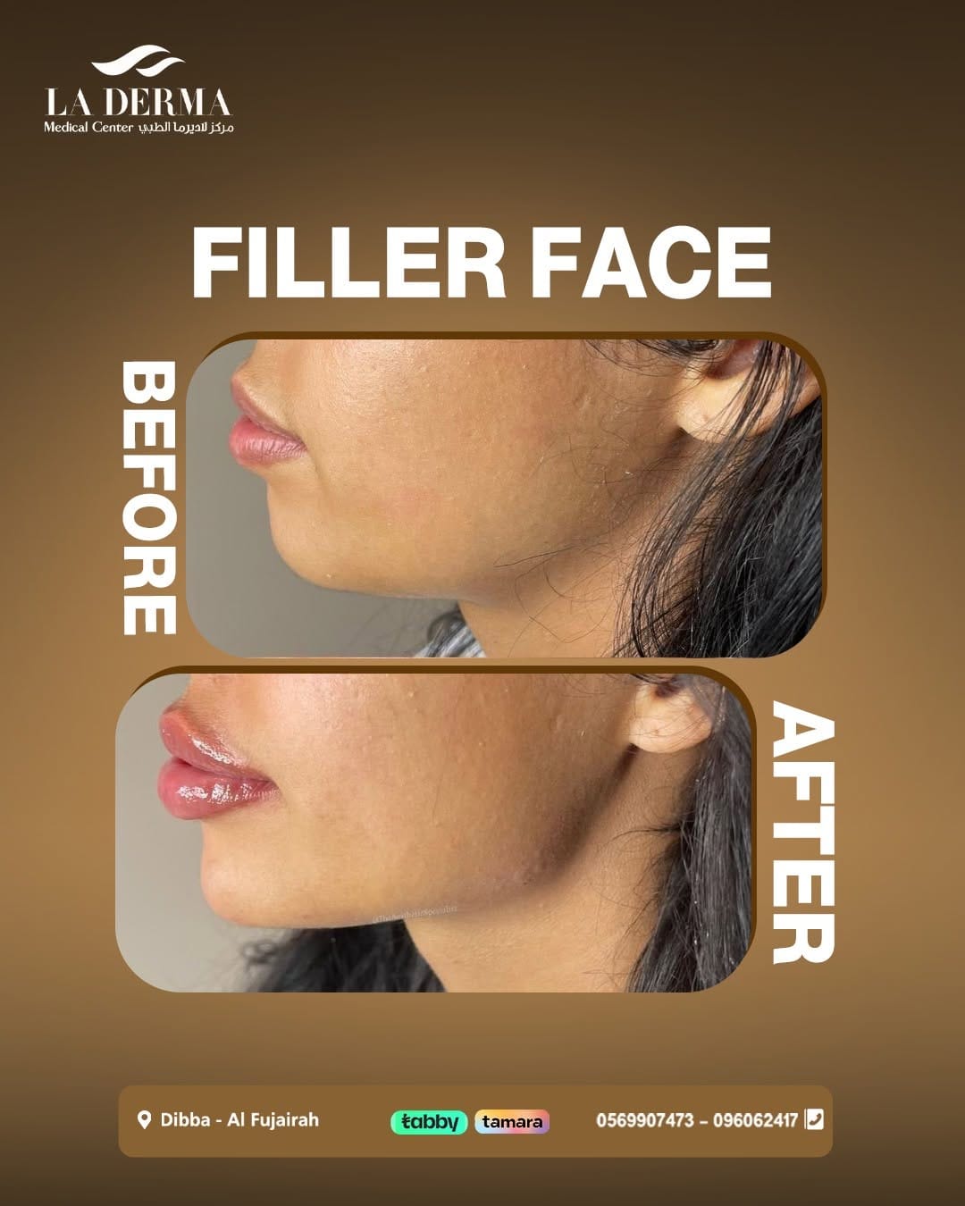 Post 8 by La Derma Medical Center on Instagram (image)
