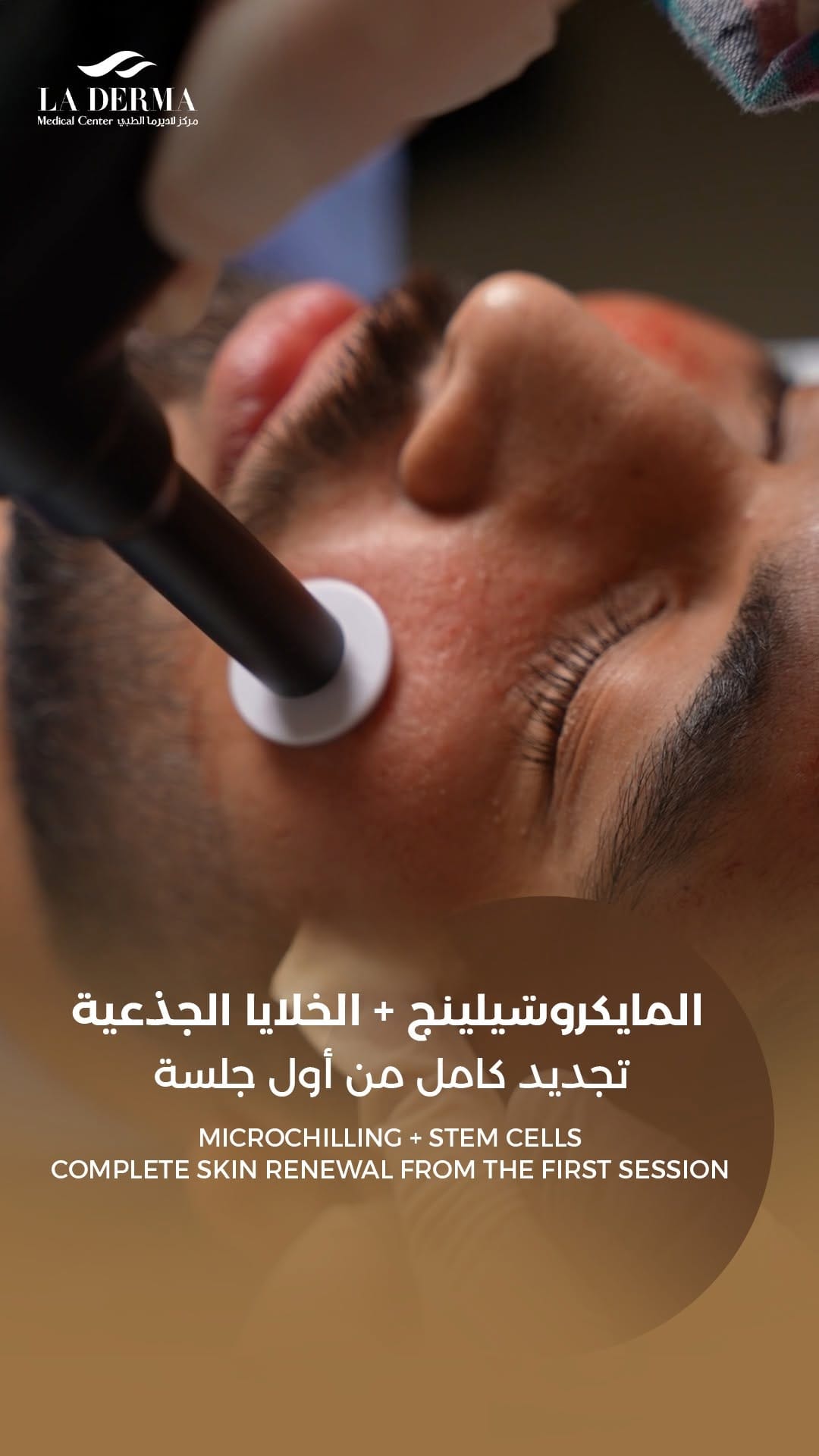 Post 1 by La Derma Medical Center on Instagram (video)
