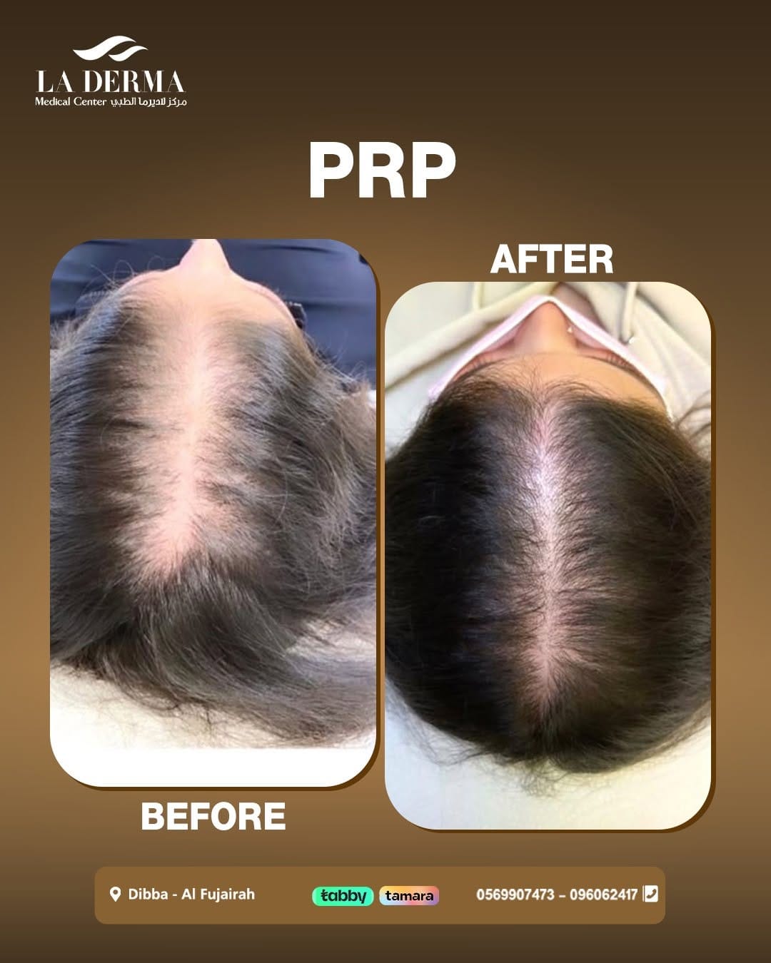 Post 9 by La Derma Medical Center on Instagram (image)