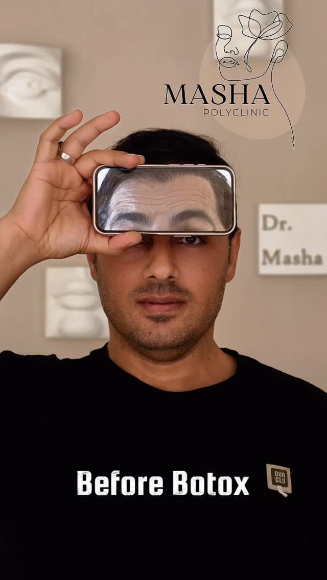 Post 10 by Dr Mahshid Sharif |  Filler Botox on Instagram (video)