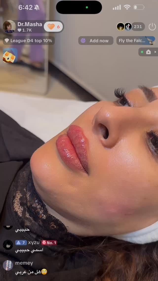 Post 4 by Dr Mahshid Sharif |  Filler Botox on Instagram (video)