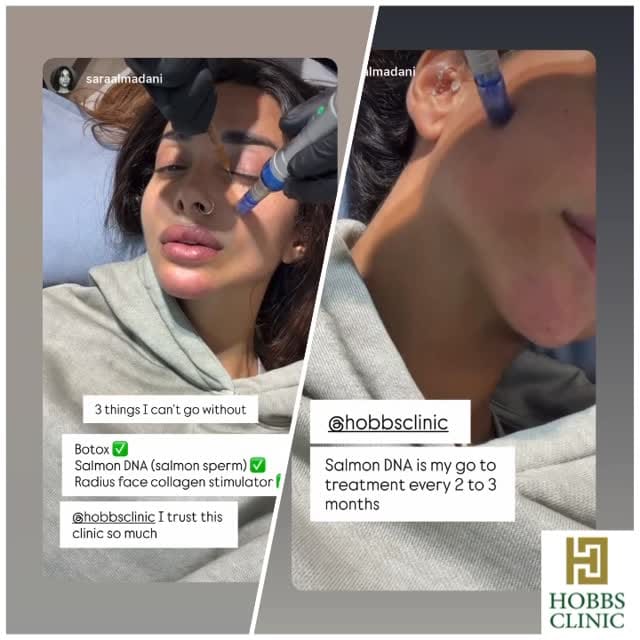 Post 5 by HOBBS Clinic - Dubai on Instagram (video)