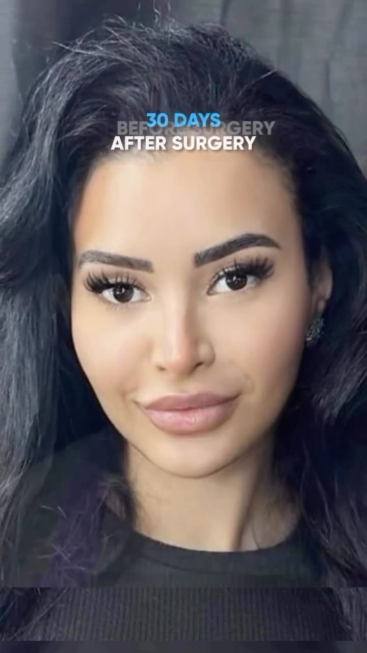 Post 8 by HOBBS Clinic - Dubai on Instagram (video)