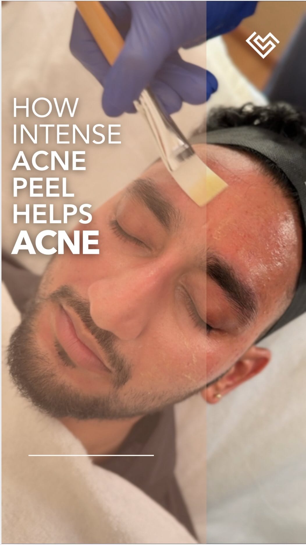 Post 4 by SkinLab Aesthetic Clinic by Dr. Jamuna Pai on Instagram (video)
