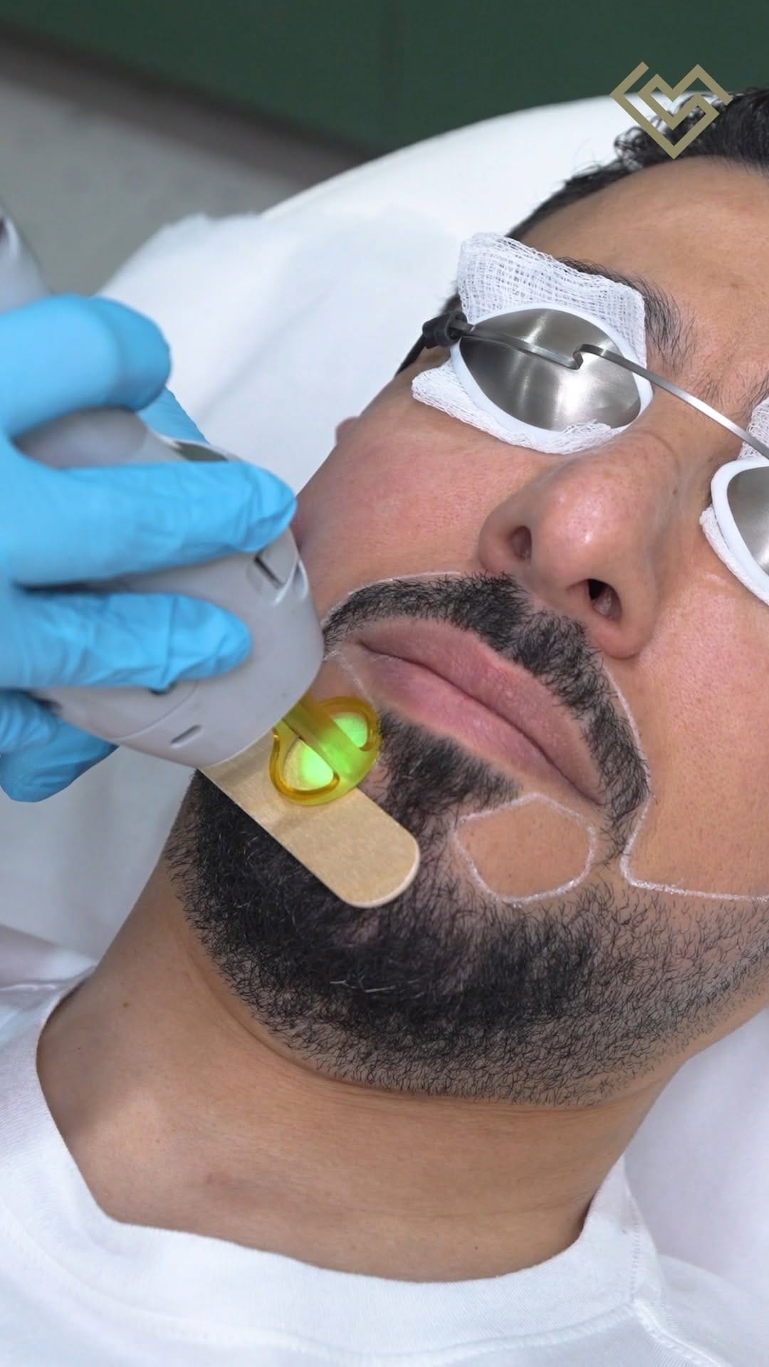 Post 6 by SkinLab Aesthetic Clinic by Dr. Jamuna Pai on Instagram (video)