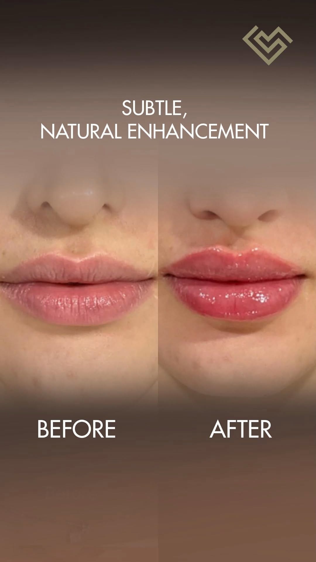 Post 1 by SkinLab Aesthetic Clinic by Dr. Jamuna Pai on Instagram (video)