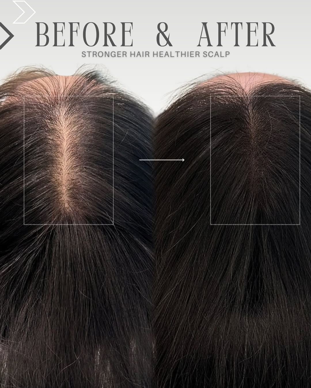 Post 6 by Bruna Oliveira | Biomédica Esteta e Tricologista on Instagram (image)