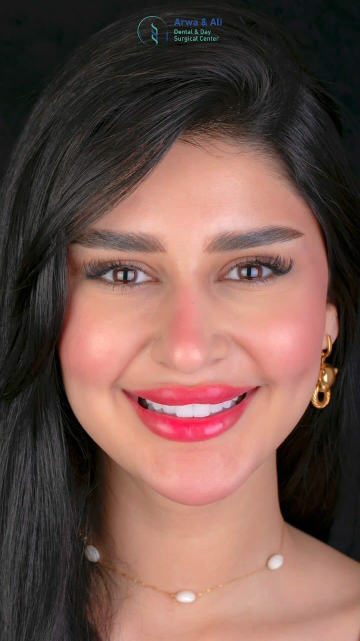 Post 10 by Dr Arwa Attallah &Dr Ali Alani | اروى عطالله on Instagram (video)