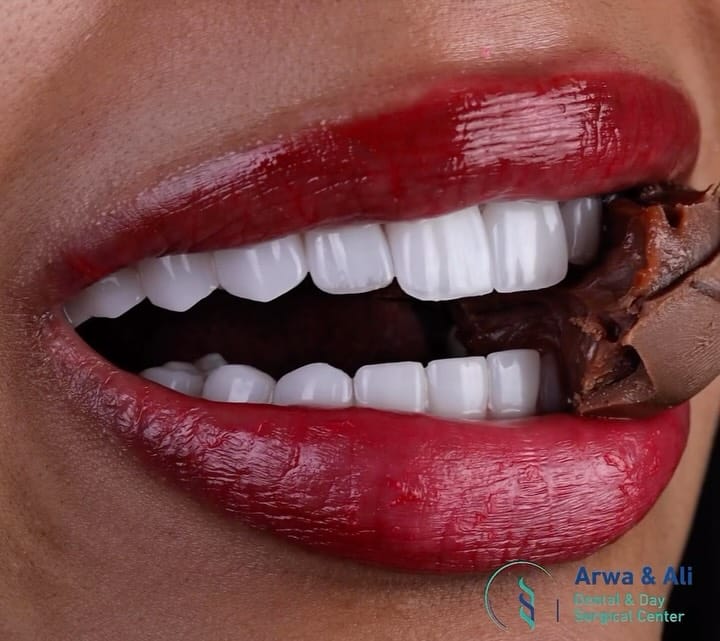 Post 4 by Dr Arwa Attallah &Dr Ali Alani | اروى عطالله on Instagram (video)
