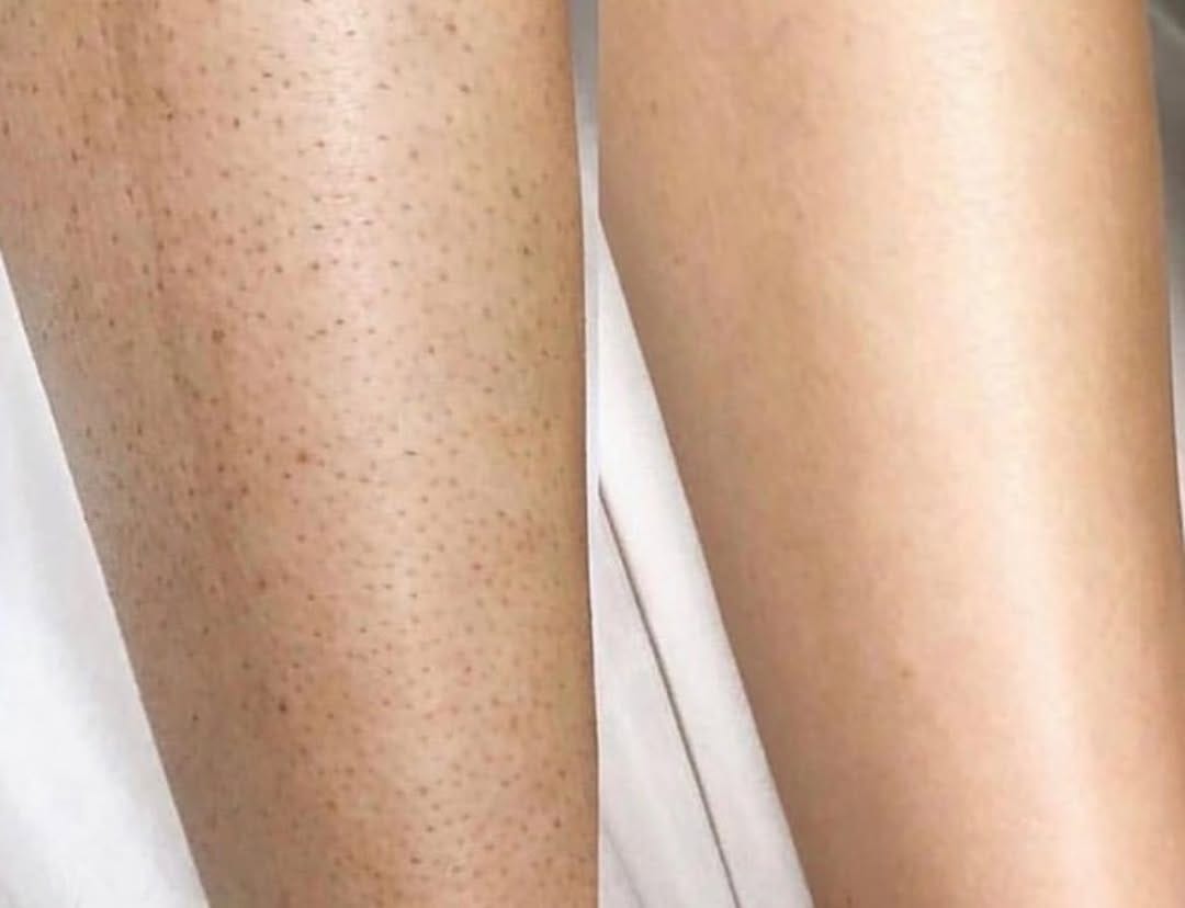 Post 6 by Mehr skin clinic on Instagram (image)