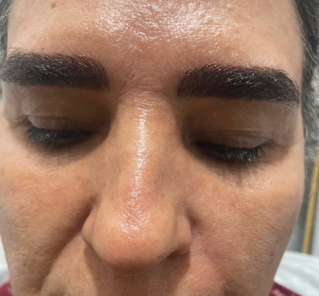 Post 3 by Mehr skin clinic on Instagram (image)