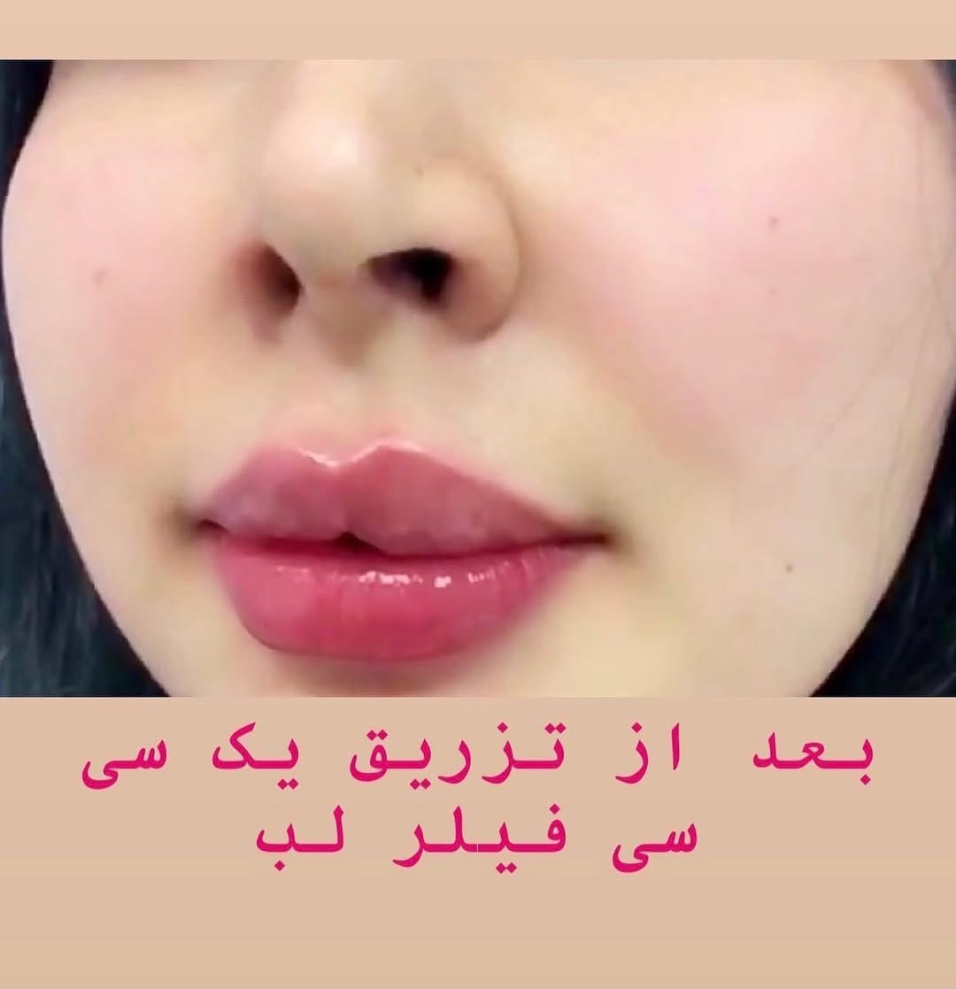 Post 5 by Mehr skin clinic on Instagram (image)