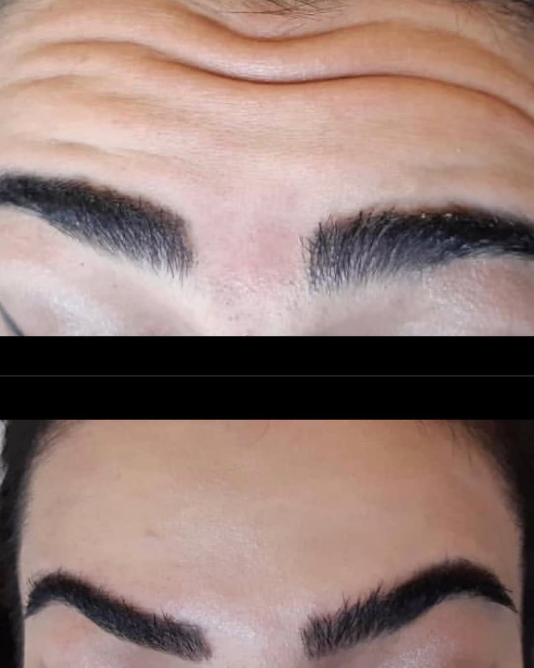 Post 2 by Mehr skin clinic on Instagram (image)
