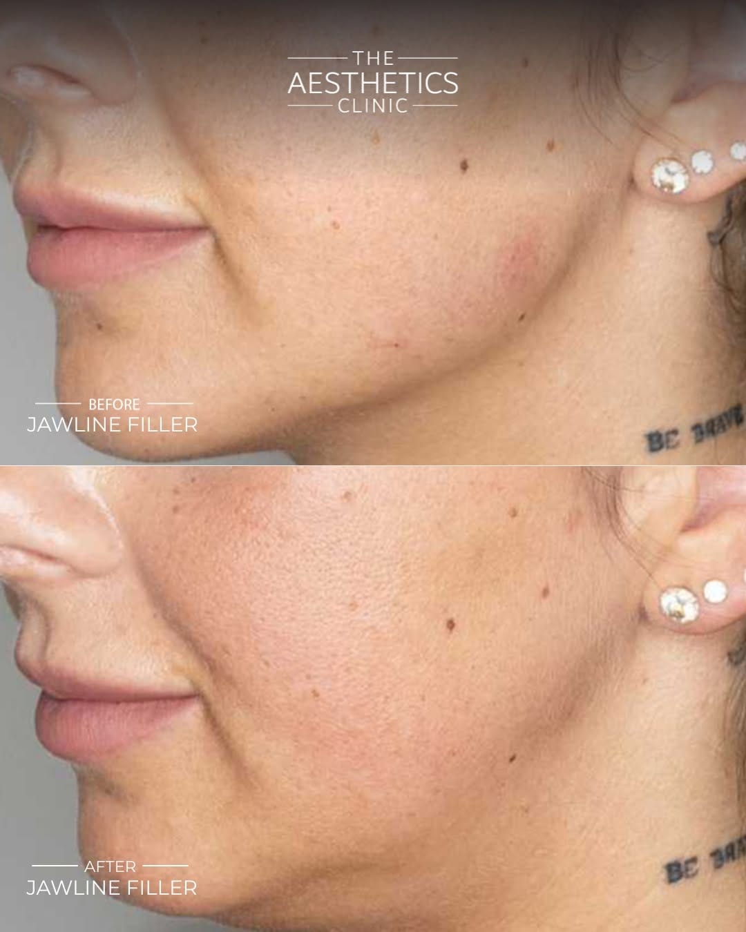 Post 1 by The Aesthetics Clinic ® on Instagram (image)